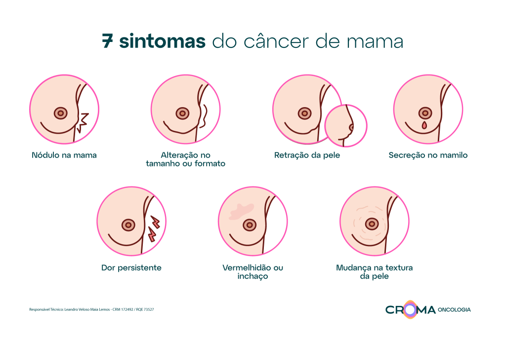 Infográfico sintomas câncer de mama