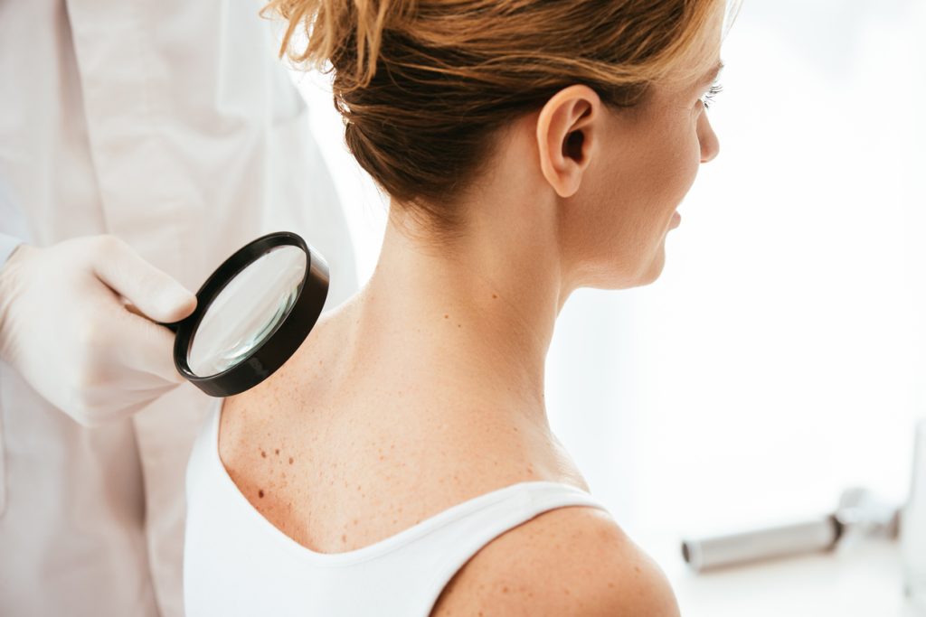 Entenda o que é o carcinoma e sua relação com o câncer