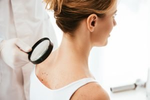 Entenda o que é o carcinoma e sua relação com o câncer
