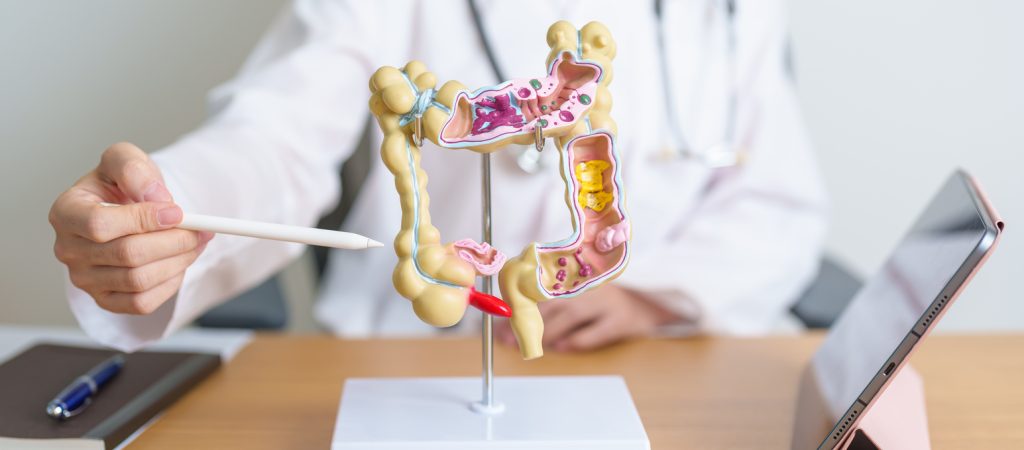 Médico demonstrando sistema retal humano