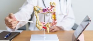 Médico demonstrando sistema retal humano