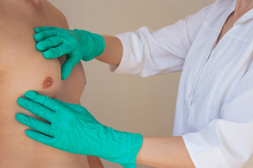 Médica examina mama masculina